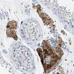 CD301 Antibody in Immunohistochemistry (Paraffin) (IHC (P))