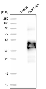 CD301 Antibody in Western Blot (WB)