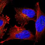 PIG3 Polyclonal Antibody