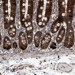 PIG3 Antibody in Immunohistochemistry (Paraffin) (IHC (P))