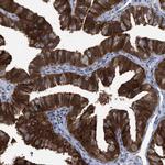 PIG3 Antibody in Immunohistochemistry (Paraffin) (IHC (P))