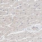 PIG3 Antibody in Immunohistochemistry (Paraffin) (IHC (P))