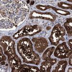 PIG3 Antibody in Immunohistochemistry (Paraffin) (IHC (P))