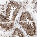 PIG3 Antibody in Immunohistochemistry (Paraffin) (IHC (P))