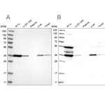 PIG3 Antibody in Western Blot (WB)