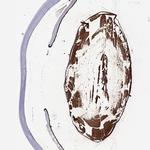 CRYBA1 Polyclonal Antibody