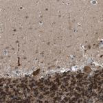 Torc1 Antibody in Immunohistochemistry (Paraffin) (IHC (P))