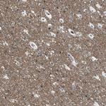 Torc1 Antibody in Immunohistochemistry (Paraffin) (IHC (P))