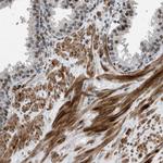 Torc1 Antibody in Immunohistochemistry (Paraffin) (IHC (P))