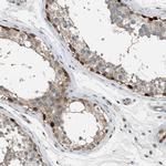 Torc1 Antibody in Immunohistochemistry (Paraffin) (IHC (P))