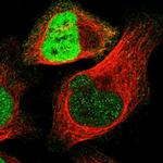 RUNX2 Polyclonal Antibody