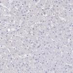 RUNX2 Antibody in Immunohistochemistry (Paraffin) (IHC (P))