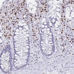 RUNX2 Antibody in Immunohistochemistry (Paraffin) (IHC (P))