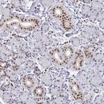 RUNX2 Antibody in Immunohistochemistry (Paraffin) (IHC (P))