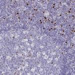 RUNX2 Antibody in Immunohistochemistry (Paraffin) (IHC (P))