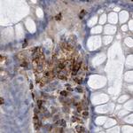 FNBP1 Antibody in Immunohistochemistry (Paraffin) (IHC (P))