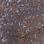 FNBP1 Antibody in Immunohistochemistry (Paraffin) (IHC (P))