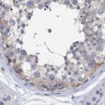 FNBP1 Antibody in Immunohistochemistry (Paraffin) (IHC (P))