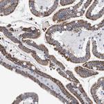 PECI Antibody in Immunohistochemistry (Paraffin) (IHC (P))