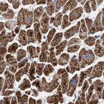 PECI Antibody in Immunohistochemistry (Paraffin) (IHC (P))