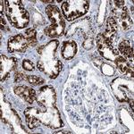 PECI Antibody in Immunohistochemistry (Paraffin) (IHC (P))