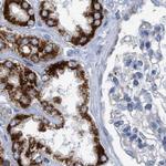 PECI Antibody in Immunohistochemistry (Paraffin) (IHC (P))