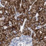 PECI Antibody in Immunohistochemistry (Paraffin) (IHC (P))