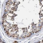 PECI Antibody in Immunohistochemistry (Paraffin) (IHC (P))