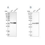 PECI Antibody in Western Blot (WB)