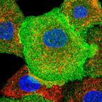 CD38 Antibody in Immunocytochemistry (ICC/IF)