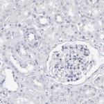 CD38 Antibody in Immunohistochemistry (Paraffin) (IHC (P))