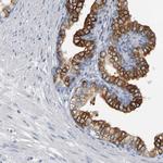 CD38 Antibody in Immunohistochemistry (Paraffin) (IHC (P))