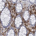 CD38 Antibody in Immunohistochemistry (Paraffin) (IHC (P))