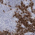 CD38 Antibody in Immunohistochemistry (Paraffin) (IHC (P))