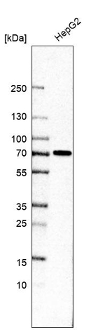 ATF2 Antibody in Western Blot (WB)