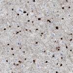 Aspartoacylase Polyclonal Antibody