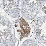 Aspartoacylase Antibody in Immunohistochemistry (Paraffin) (IHC (P))