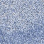 Aspartoacylase Antibody in Immunohistochemistry (Paraffin) (IHC (P))