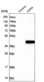 Aspartoacylase Antibody in Western Blot (WB)
