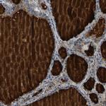 PDE1A Polyclonal Antibody