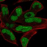 CHD1 Polyclonal Antibody