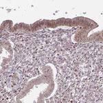 CHD1 Antibody in Immunohistochemistry (Paraffin) (IHC (P))