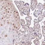 CHD1 Antibody in Immunohistochemistry (Paraffin) (IHC (P))