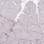 CHD1 Antibody in Immunohistochemistry (Paraffin) (IHC (P))