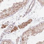 CHD1 Antibody in Immunohistochemistry (Paraffin) (IHC (P))