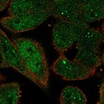 ZWINT Polyclonal Antibody