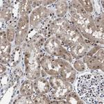 ATP Citrate Lyase Antibody in Immunohistochemistry (Paraffin) (IHC (P))