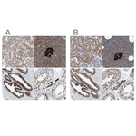 ATP Citrate Lyase Antibody in Immunohistochemistry (Paraffin) (IHC (P))