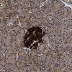 ATP Citrate Lyase Antibody in Immunohistochemistry (Paraffin) (IHC (P))