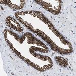 ATP Citrate Lyase Antibody in Immunohistochemistry (Paraffin) (IHC (P))